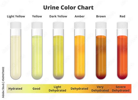 peeing ebony|Pee Color Chart: Meaning of Pale to Dark Shades .